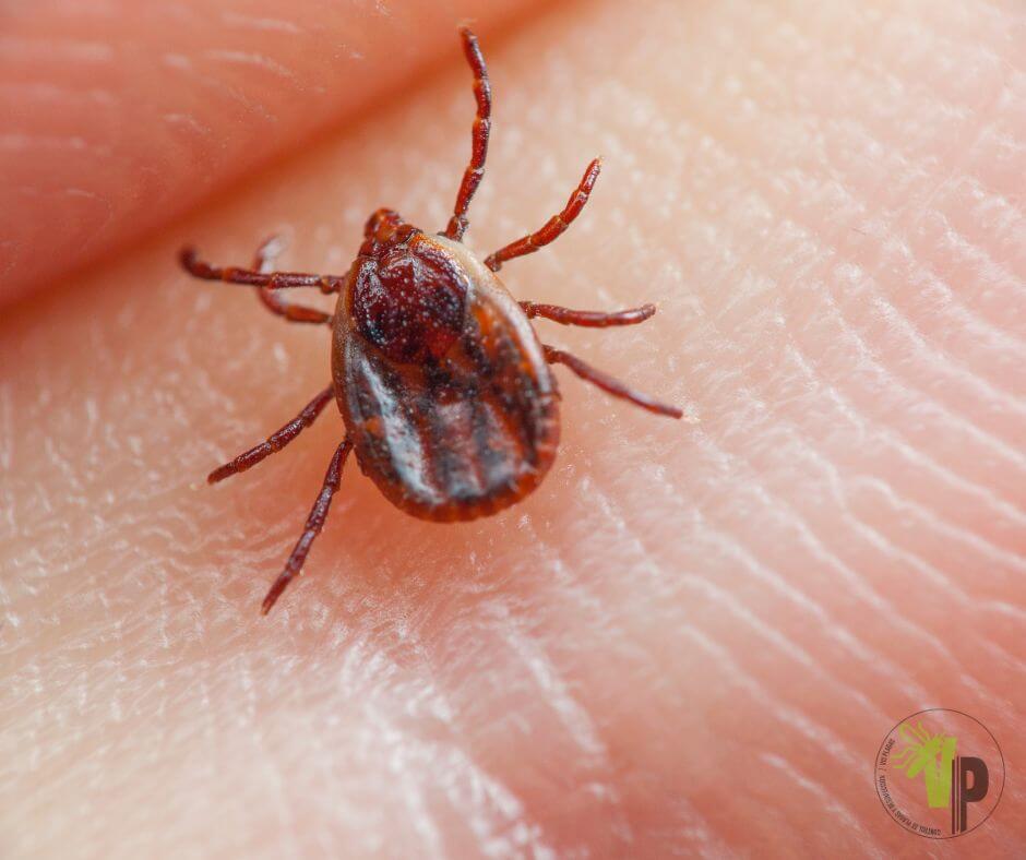 Garrapata sobre la piel humana, mostrando detalle de sus patas y cuerpo